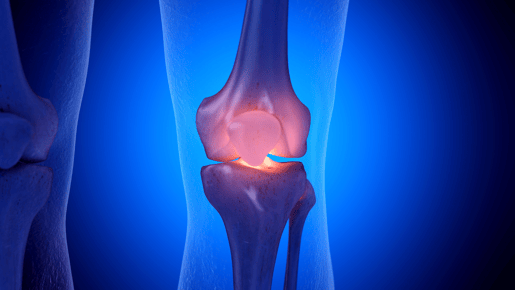 Use Case: Reanalyzing Public RNA-seq Data of IL-17A-Induced Changes in Osteoarthritis Cell Models